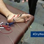6 Common Questions About Dry Needling